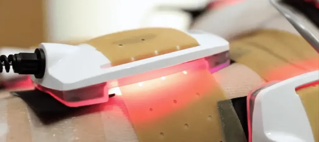 Machine Soins Corps - Technologies Body Synergy laser