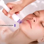 Face-Aqua-micro-derma-fusion-Scarlett-Beauty-