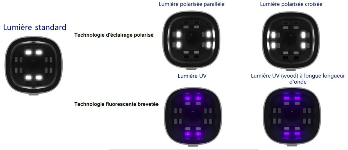 Face Diag -Scarlett Beauty - types de technologies - Scarlett Beauty - Braine l'Alleud - Belgique