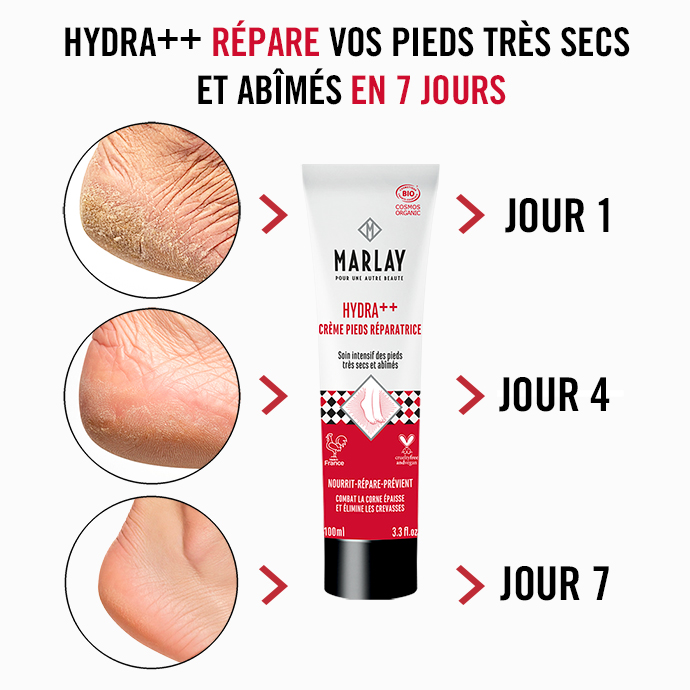 Crème Hydratante Intense Marlay – soin nourrissant et hydratant pour pieds secs