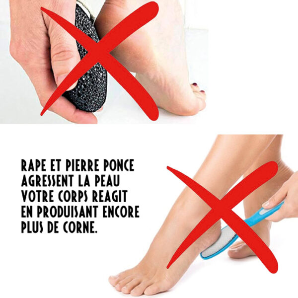 Râpe et pierre ponce sur les pieds barrées d’une croix rouge