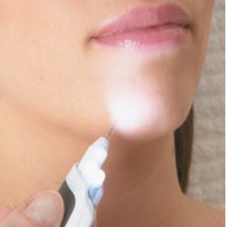 Depil-520-aiguille-lumiere-depil-beaute-scarlett-beauty-braine-lalleud